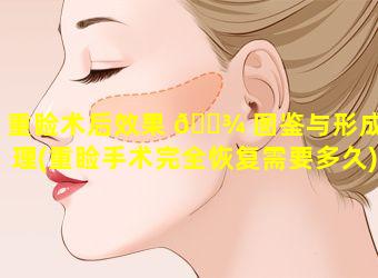 重睑术后效果 🌾 图鉴与形成原理(重睑手术完全恢复需要多久)